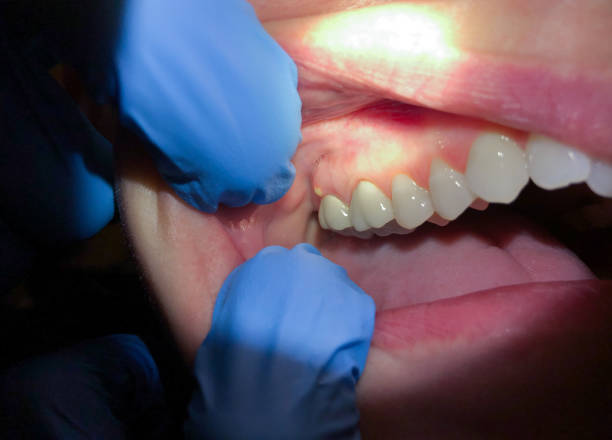 Best Broken Tooth Emergency  in Bridgewater Center, NJ